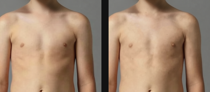 V7FEV_TORSO_A7.png